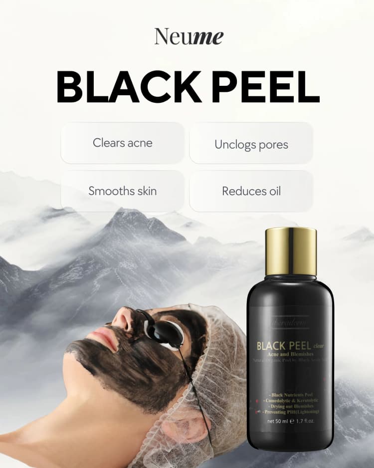 Black Peel