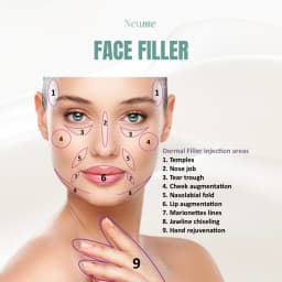 Cheek Filler