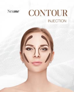 Contour Injection