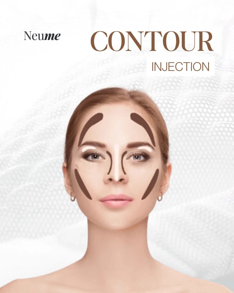 Contour Injection