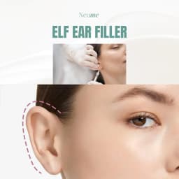 Elf Ear Filler