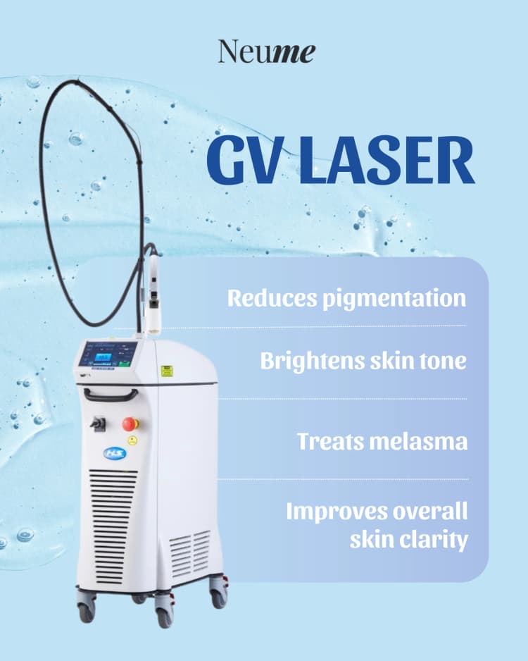 GV Laser