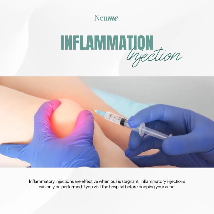 Inflammatory Acne Injection