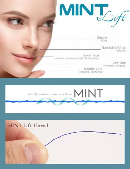 Mint Thread Lifting