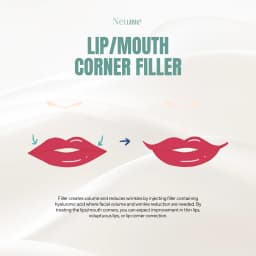 Lip Corner Filler