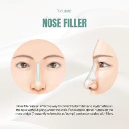 Nose Filler