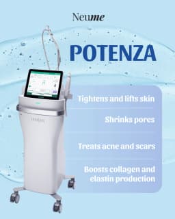Potenza Laser