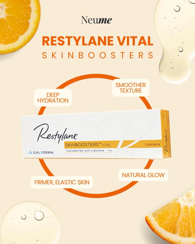 Restylane Vital
