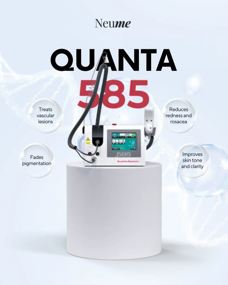 Quanta 585 Laser