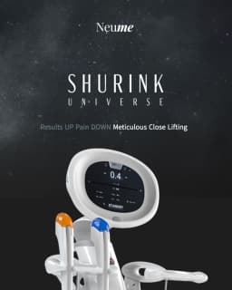 Shurink Universe