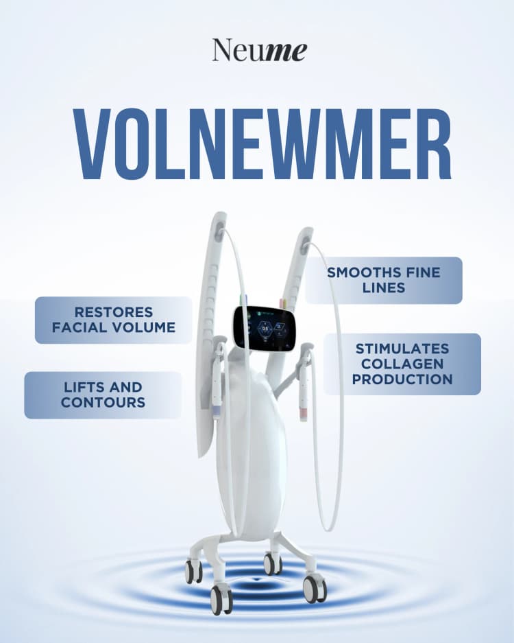 Volnewmer